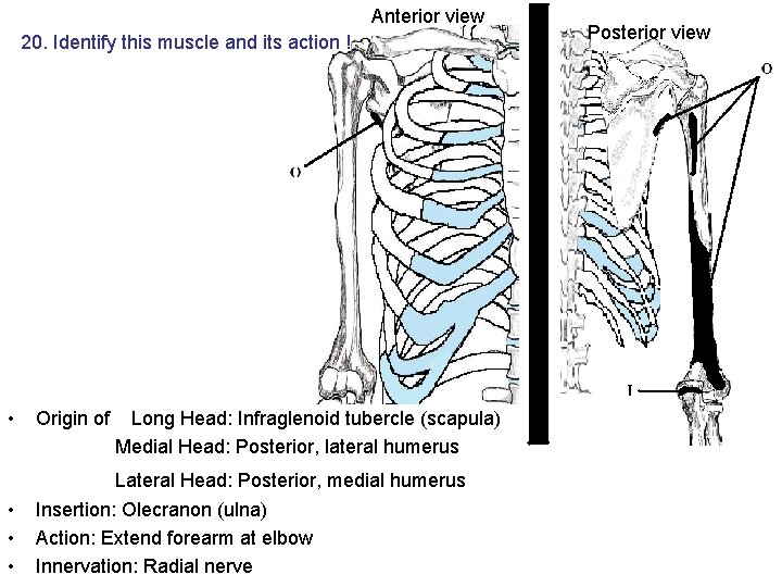 Anterior view 20. Identify this muscle and its action ! • Origin of Long Anterior view 20. Identify this muscle and its action ! • Origin of Long