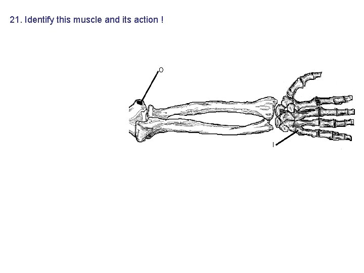 21. Identify this muscle and its action ! 21. Identify this muscle and its action !