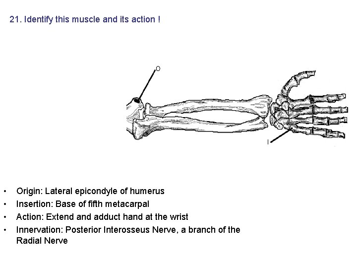 21. Identify this muscle and its action ! • • Origin: Lateral epicondyle of 21. Identify this muscle and its action ! • • Origin: Lateral epicondyle of