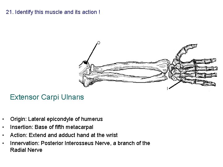 21. Identify this muscle and its action ! Extensor Carpi Ulnaris • • Origin: 21. Identify this muscle and its action ! Extensor Carpi Ulnaris • • Origin: