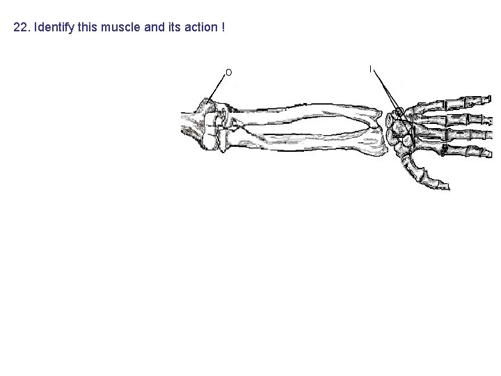22. Identify this muscle and its action ! 22. Identify this muscle and its action !