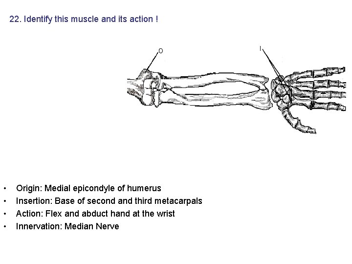 22. Identify this muscle and its action ! • • Origin: Medial epicondyle of 22. Identify this muscle and its action ! • • Origin: Medial epicondyle of