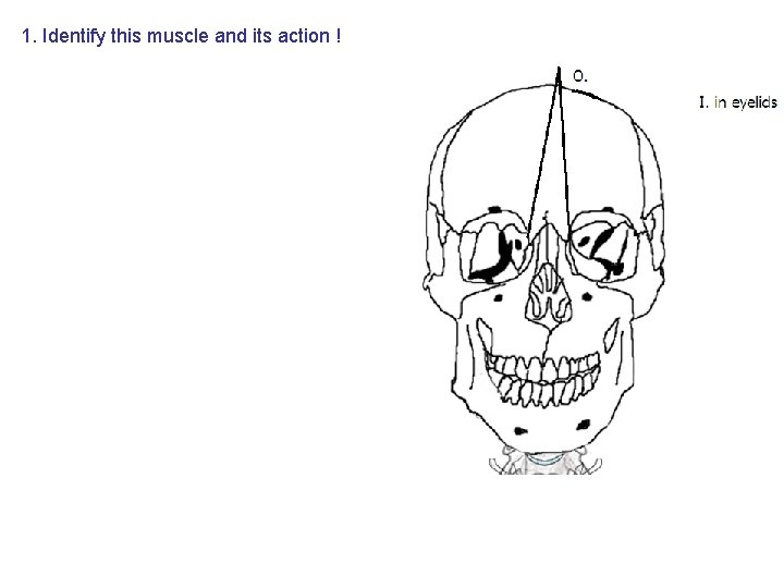 1. Identify this muscle and its action ! 1. Identify this muscle and its action !