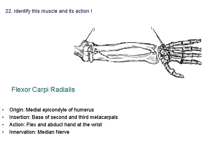 22. Identify this muscle and its action ! Flexor Carpi Radialis • • Origin: 22. Identify this muscle and its action ! Flexor Carpi Radialis • • Origin: