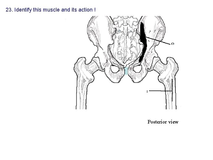 23. Identify this muscle and its action ! Posterior view 23. Identify this muscle and its action ! Posterior view