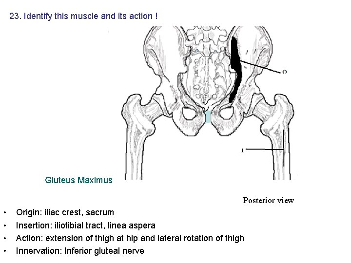 23. Identify this muscle and its action ! Gluteus Maximus Posterior view • • 23. Identify this muscle and its action ! Gluteus Maximus Posterior view • •