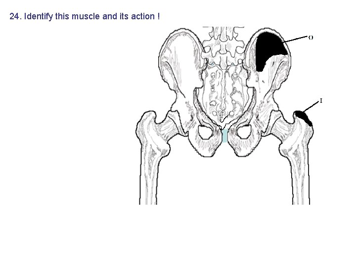 24. Identify this muscle and its action ! 24. Identify this muscle and its action !