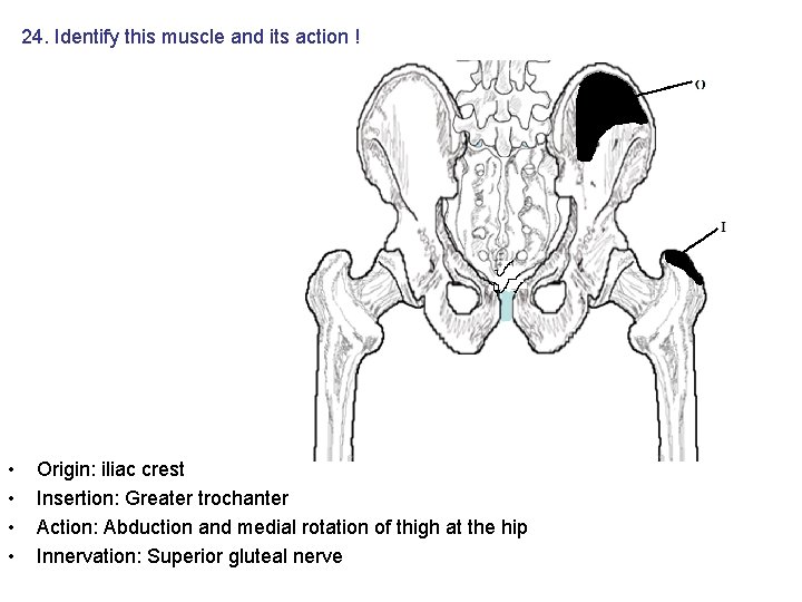 24. Identify this muscle and its action ! • • Origin: iliac crest Insertion: 24. Identify this muscle and its action ! • • Origin: iliac crest Insertion: