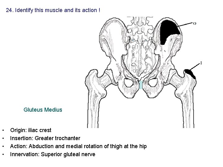 24. Identify this muscle and its action ! Gluteus Medius • • Origin: iliac 24. Identify this muscle and its action ! Gluteus Medius • • Origin: iliac