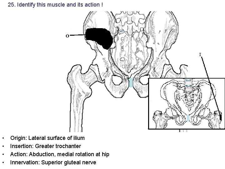 25. Identify this muscle and its action ! • • Origin: Lateral surface of 25. Identify this muscle and its action ! • • Origin: Lateral surface of