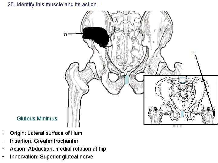 25. Identify this muscle and its action ! Gluteus Minimus • • Origin: Lateral 25. Identify this muscle and its action ! Gluteus Minimus • • Origin: Lateral
