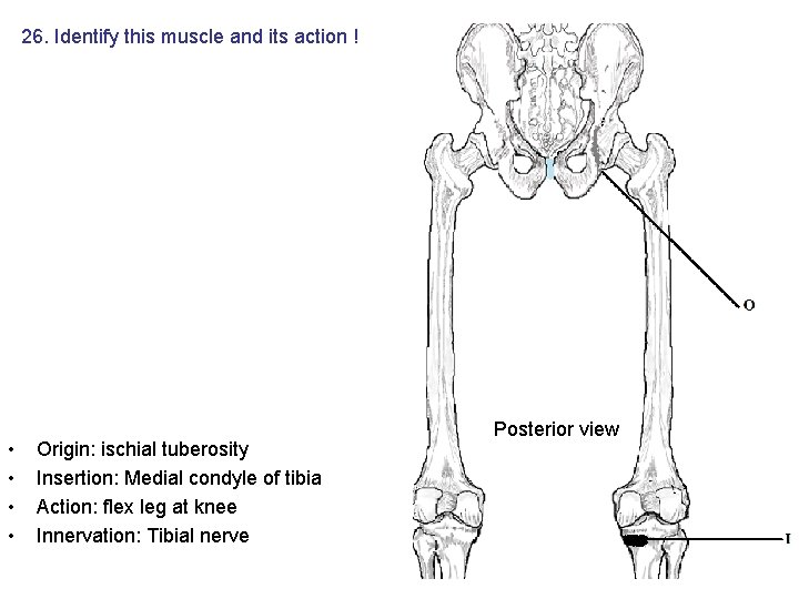 26. Identify this muscle and its action ! • • Origin: ischial tuberosity Insertion: 26. Identify this muscle and its action ! • • Origin: ischial tuberosity Insertion: