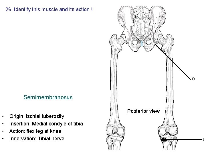 26. Identify this muscle and its action ! Semimembranosus • • Origin: ischial tuberosity 26. Identify this muscle and its action ! Semimembranosus • • Origin: ischial tuberosity