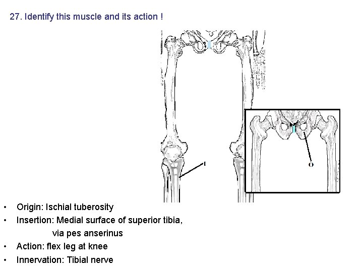 27. Identify this muscle and its action ! • • Origin: Ischial tuberosity Insertion: 27. Identify this muscle and its action ! • • Origin: Ischial tuberosity Insertion: