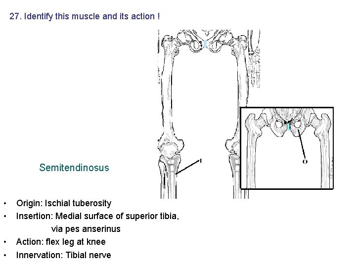 27. Identify this muscle and its action ! Semitendinosus • • Origin: Ischial tuberosity 27. Identify this muscle and its action ! Semitendinosus • • Origin: Ischial tuberosity