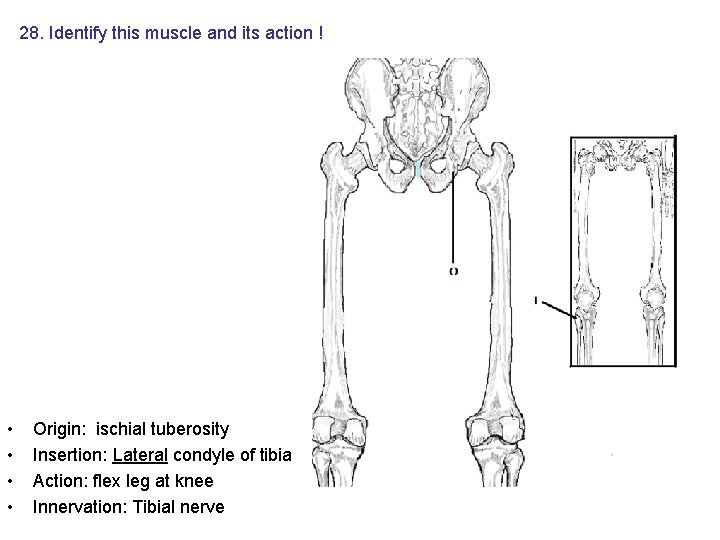 28. Identify this muscle and its action ! • • Origin: ischial tuberosity Insertion: 28. Identify this muscle and its action ! • • Origin: ischial tuberosity Insertion: