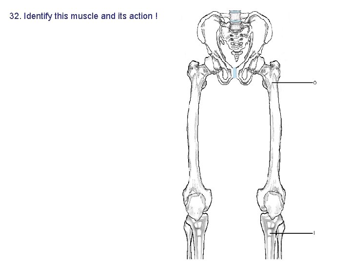 32. Identify this muscle and its action ! 32. Identify this muscle and its action !