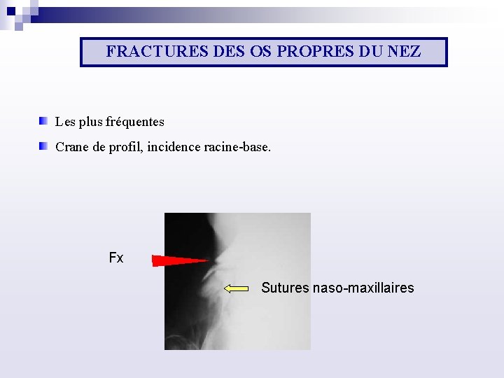 LES TRAUMATISMES DE LA FACE DR MRAD DALI