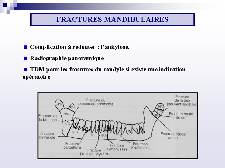 FRACTURES MANDIBULAIRES Complication à redouter : l’ankylose. Radiographie panoramique TDM pour les fractures du