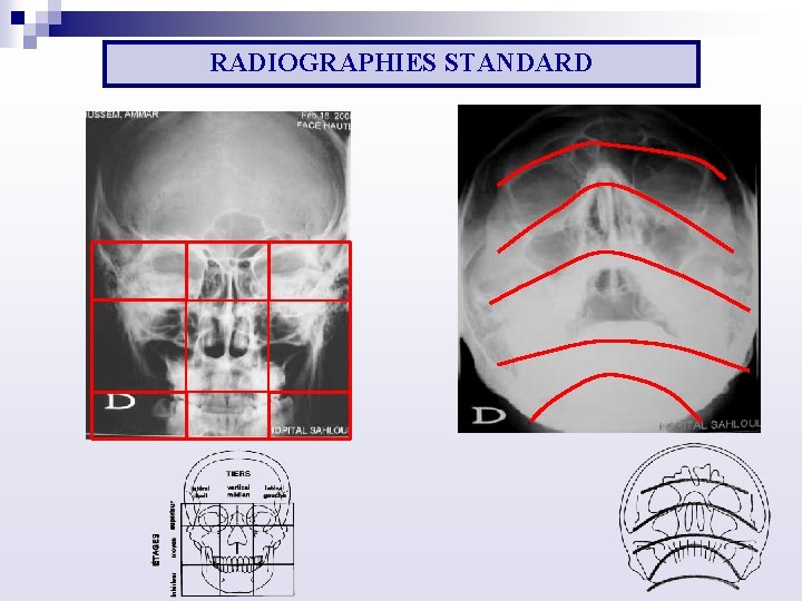 RADIOGRAPHIES STANDARD 