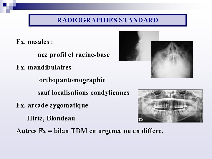 RADIOGRAPHIES STANDARD Fx. nasales : nez profil et racine base Fx. mandibulaires orthopantomographie sauf