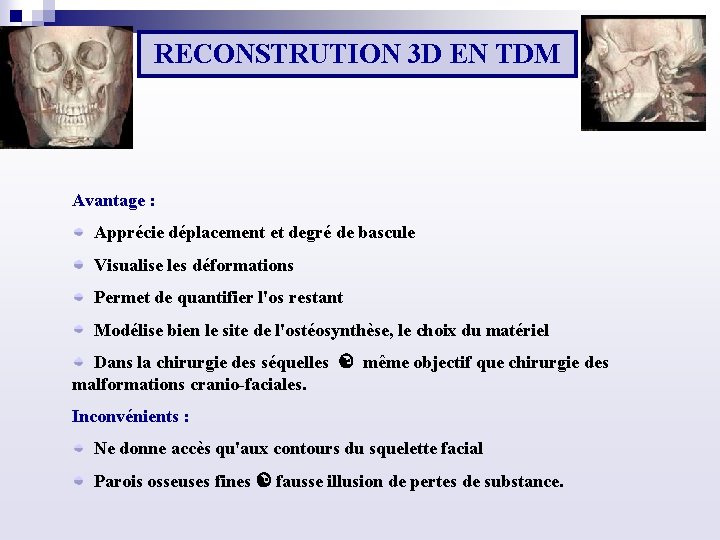 RECONSTRUTION 3 D EN TDM Avantage : Apprécie déplacement et degré de bascule Visualise