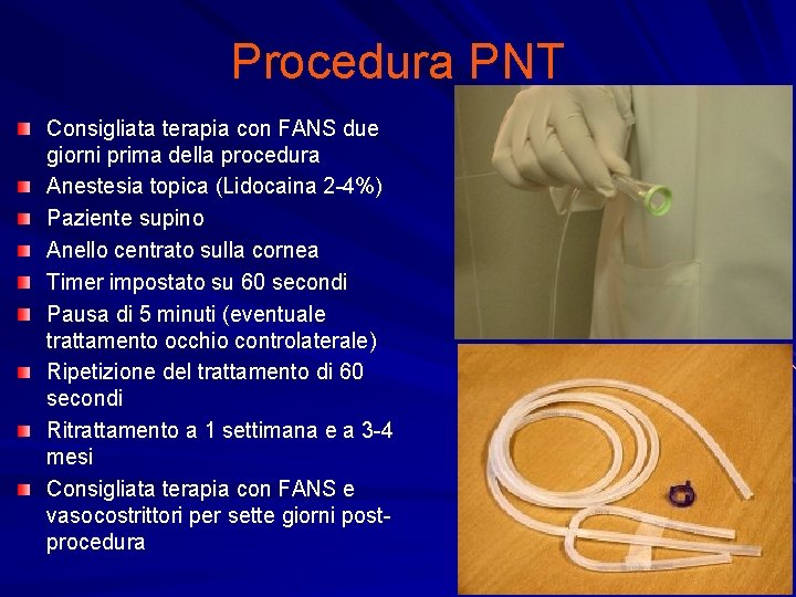 Procedura PNT Consigliata terapia con FANS due giorni prima della procedura Anestesia topica (Lidocaina