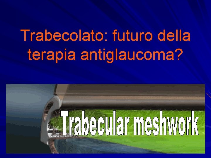 Trabecolato: futuro della terapia antiglaucoma? 