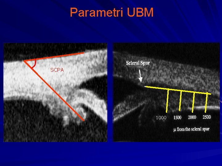 Parametri UBM SCPA 1000 