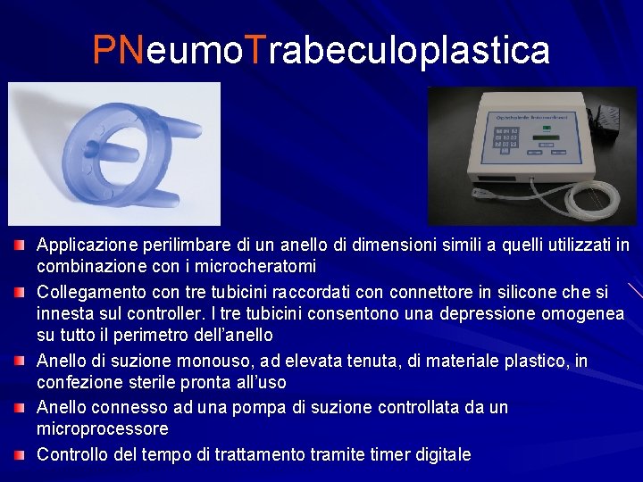 PNeumo. Trabeculoplastica Applicazione perilimbare di un anello di dimensioni simili a quelli utilizzati in