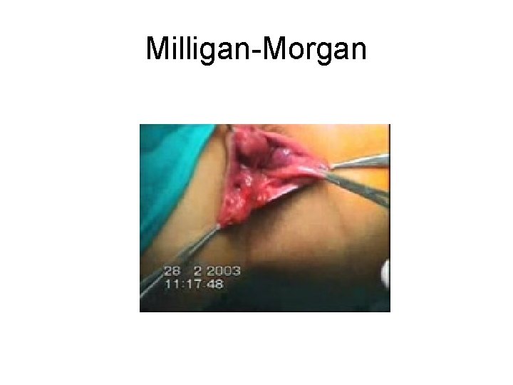 Milligan-Morgan 