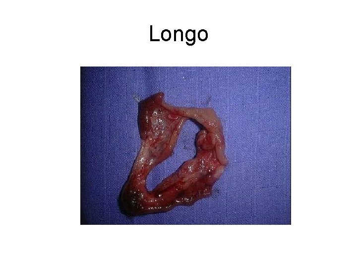 Longo 