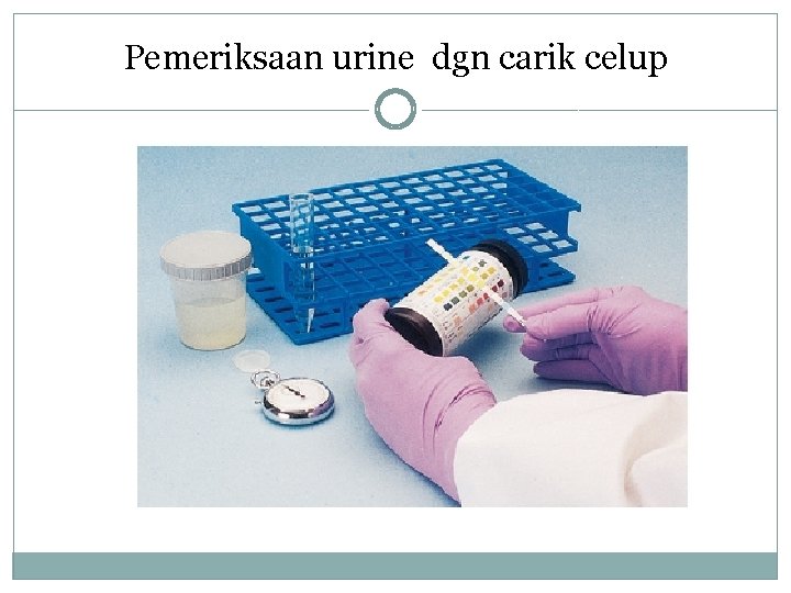 Pemeriksaan urine dgn carik celup 