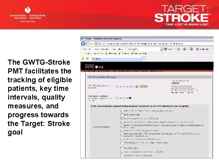 The GWTG-Stroke PMT facilitates the tracking of eligible patients, key time intervals, quality measures,