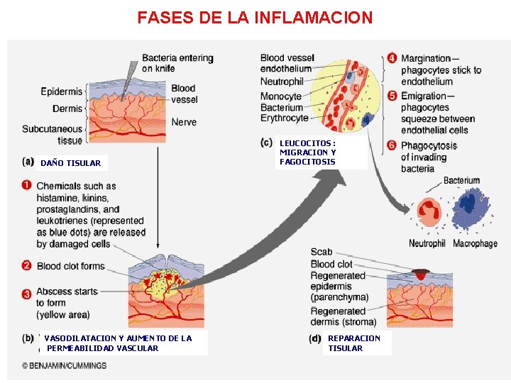 FASES DE LA INFLAMACION DAÑO TISULAR VASODILATACION Y AUMENTO DE LA PERMEABILIDAD VASCULAR LEUCOCITOS
