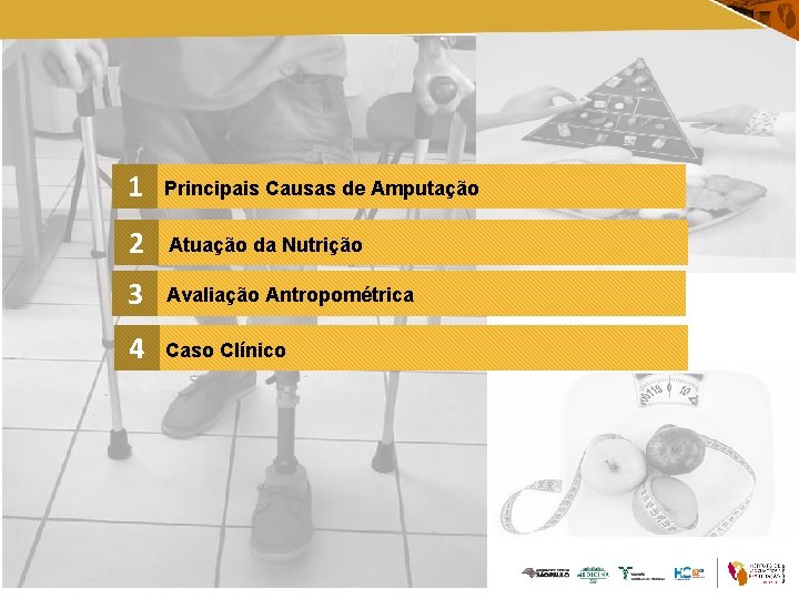 1 Principais Causas de Amputação 2 Atuação da Nutrição 3 Avaliação Antropométrica 4 Caso