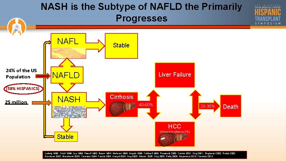 NASH is the Subtype of NAFLD the Primarily Progresses NAFL 24% of the US