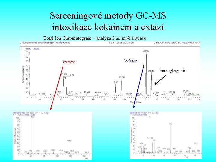 Screeningové metody GC-MS intoxikace kokainem a extází Total Ion Chromatogram – analýza 2 ml