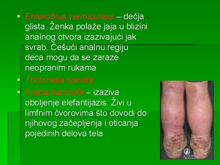 § Enterobius vermicularis – dečja glista. Ženka polaže jaja u blizini analnog otvora izazivajući