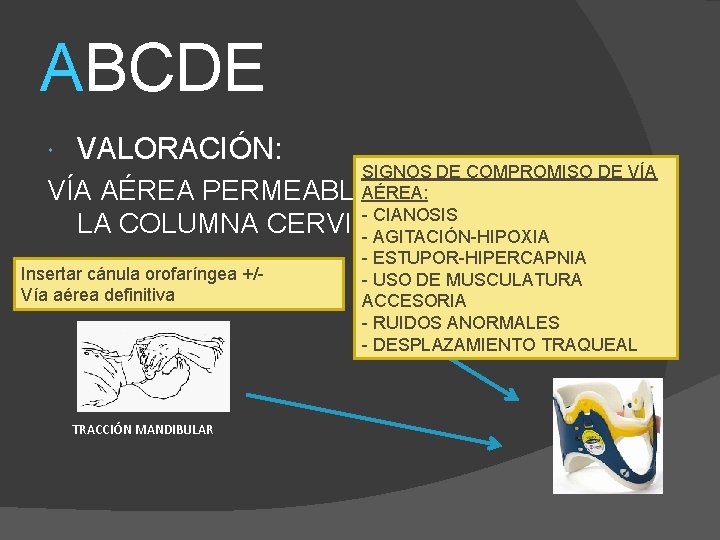 ABCDE VALORACIÓN: SIGNOS DE COMPROMISO DE VÍA AÉREA PERMEABLEAÉREA: CONTROL DE - CIANOSIS LA