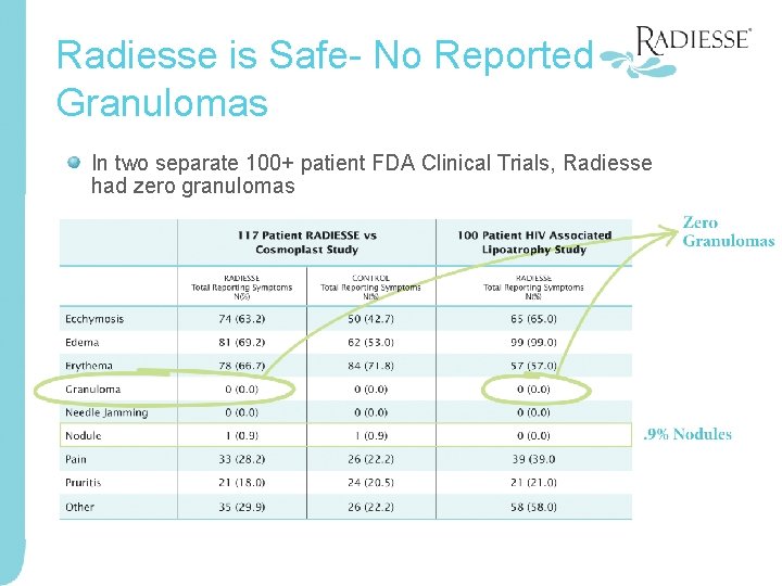 Radiesse is Safe- No Reported Granulomas In two separate 100+ patient FDA Clinical Trials,