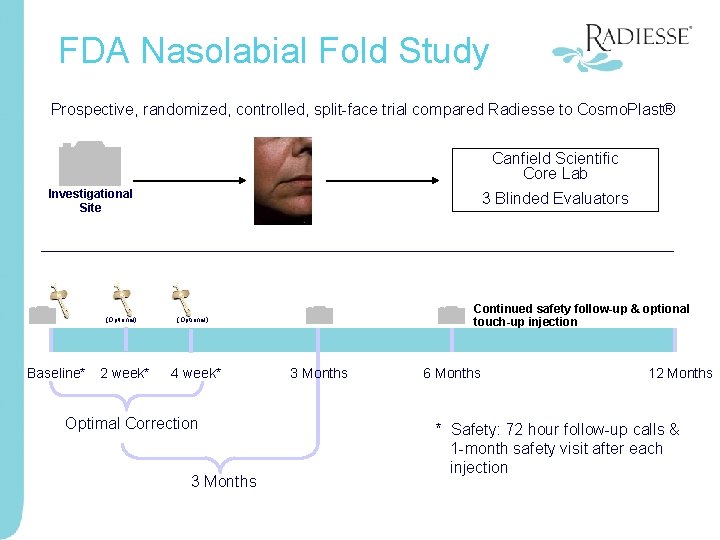 FDA Nasolabial Fold Study Prospective, randomized, controlled, split-face trial compared Radiesse to Cosmo. Plast®