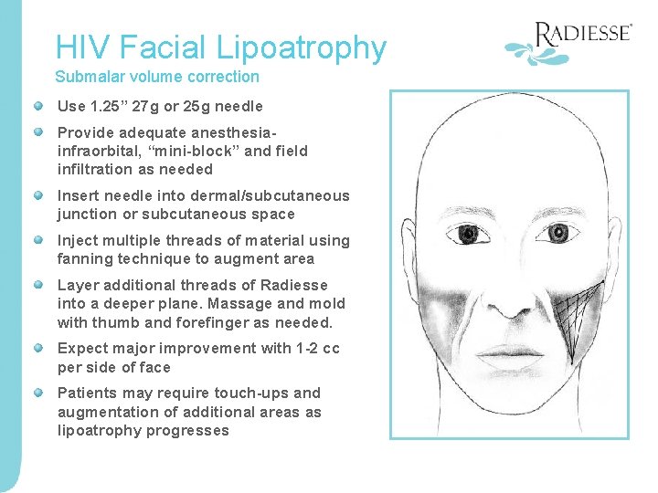HIV Facial Lipoatrophy Submalar volume correction Use 1. 25” 27 g or 25 g