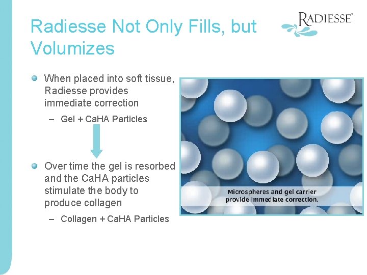 Radiesse Not Only Fills, but Volumizes When placed into soft tissue, Radiesse provides immediate