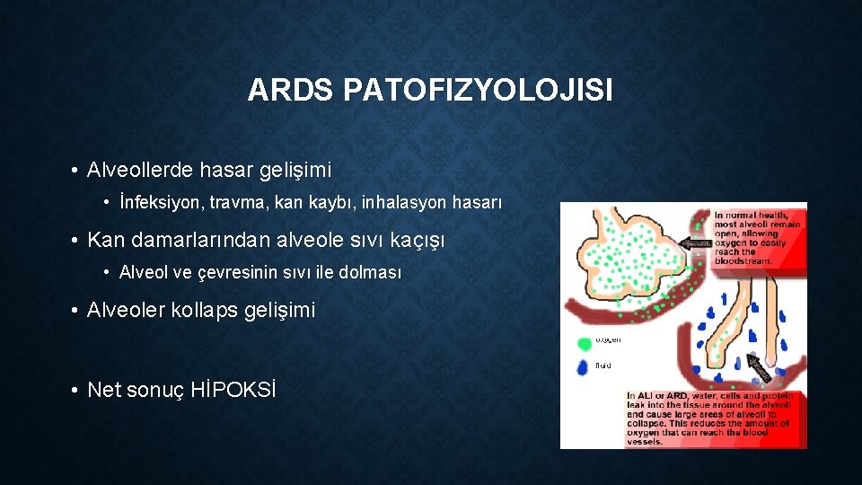 ARDS PATOFIZYOLOJISI • Alveollerde hasar gelişimi • İnfeksiyon, travma, kan kaybı, inhalasyon hasarı •