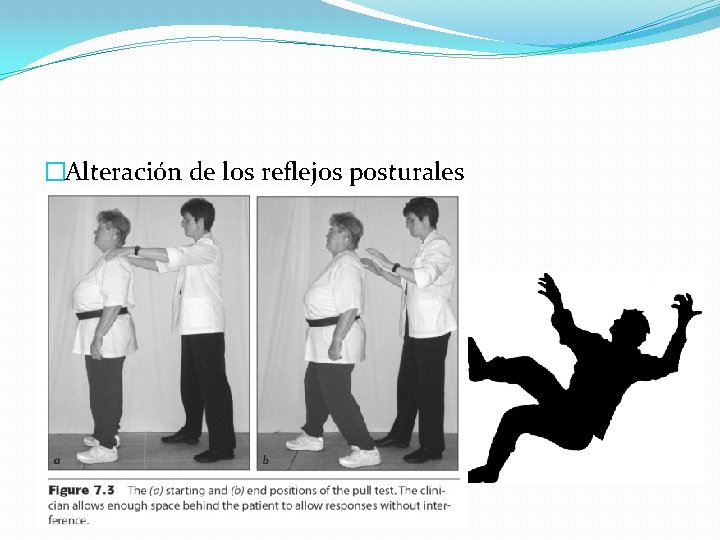 �Alteración de los reflejos posturales 