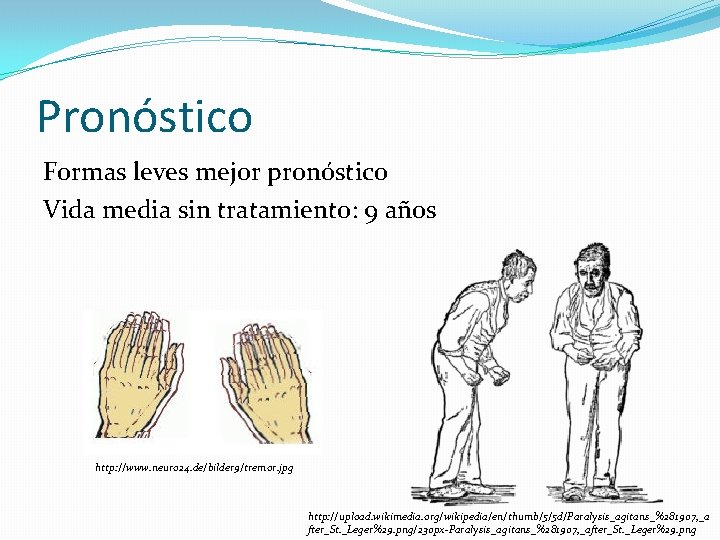 Pronóstico Formas leves mejor pronóstico Vida media sin tratamiento: 9 años http: //www. neuro