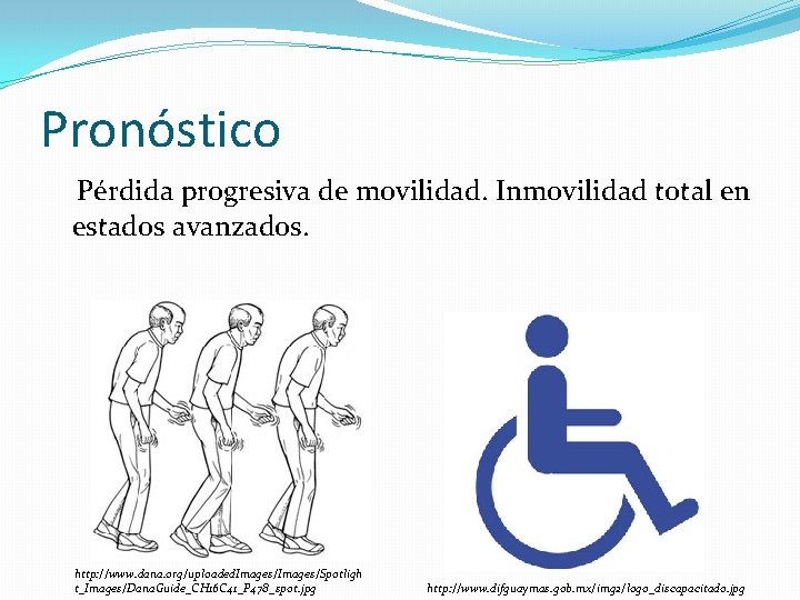 Pronóstico Pérdida progresiva de movilidad. Inmovilidad total en estados avanzados. http: //www. dana. org/uploaded.