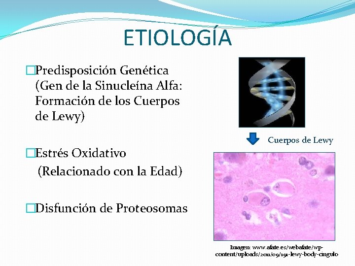 ETIOLOGÍA �Predisposición Genética (Gen de la Sinucleína Alfa: Formación de los Cuerpos de Lewy)