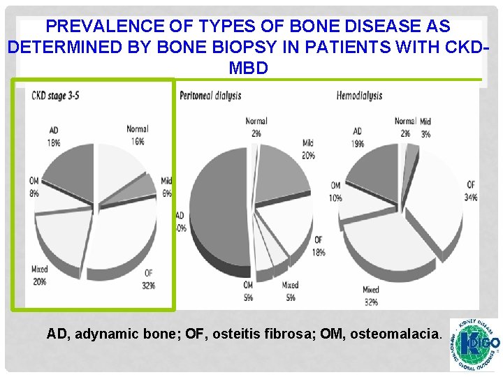 PREVALENCE OF TYPES OF BONE DISEASE AS DETERMINED BY BONE BIOPSY IN PATIENTS WITH